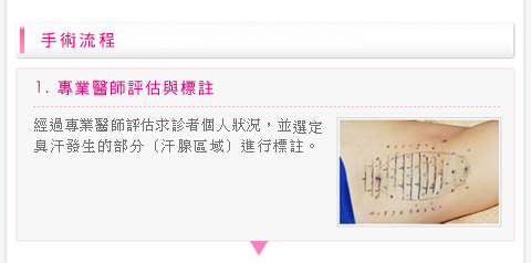 彭玉文医师3合1极细光纤腋下除味术